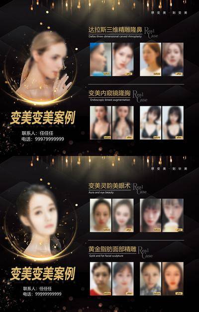 【南门网dcpsd.com】广告 海报 医美 对比 案例 背景版 大展板 暗金 变美 案例 对比 展示 流光 精雕 隆胸 面部 眼鼻胸 术前 术后 传单