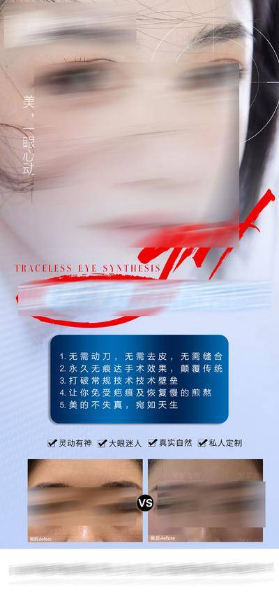 【南门网dcpsd.com】海报 医美 人物 双眼皮 整形 眼综合 案例 对比