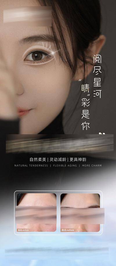 【南门网dcpsd.com】海报 医美 人物 双眼皮 整形 眼综合 案例 对比