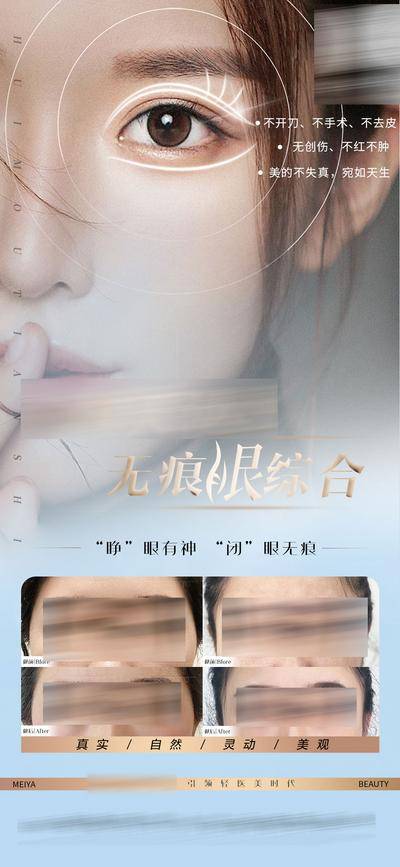 【南门网dcpsd.com】海报 医美 人物 双眼皮 整形 眼综合 案例 对比