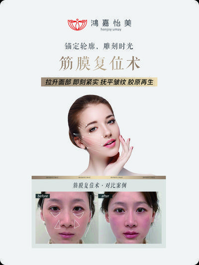 【南门网dcpsd.com】广告 海报 医美 案例 对比 轮廓 时光