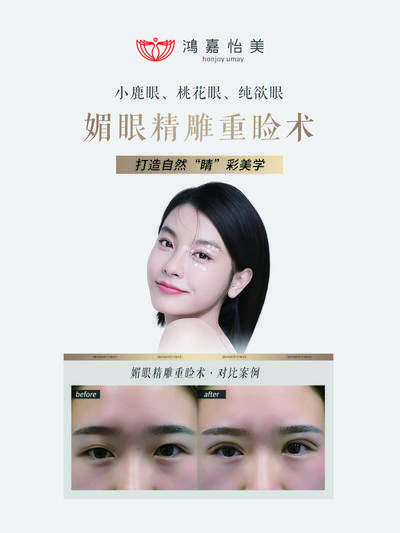 【南门网dcpsd.com】广告 海报 医美 案例 对比 轮廓 时光 整形 双眼皮