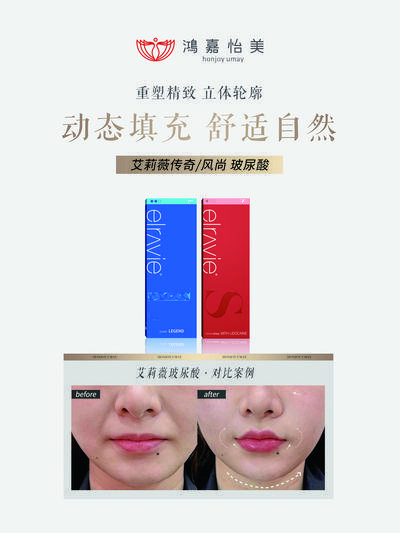 【南门网dcpsd.com】广告 海报 医美 案例 对比 轮廓 时光 填充