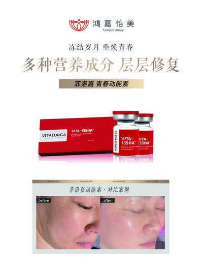 【南门网dcpsd.com】广告 海报 医美 案例 对比 轮廓 时光 美白 修复