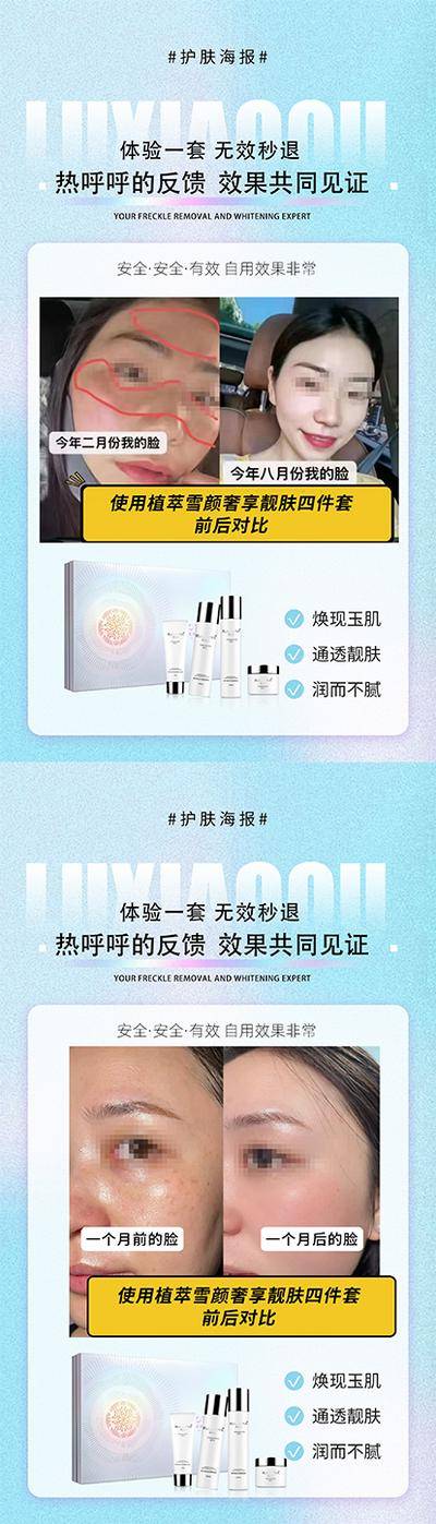 【南门网dcpsd.com】广告 海报 医美 案例 系列 填充 自体脂肪 胶原蛋白 全脸填充 美容 对比图 真人案例 祛斑 抗衰 对比
