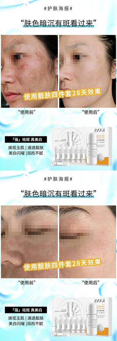 【南门网dcpsd.com】广告 海报 医美 案例 系列 填充 自体脂肪 胶原蛋白 全脸填充 美容 对比图 真人案例 祛斑 抗衰 对比