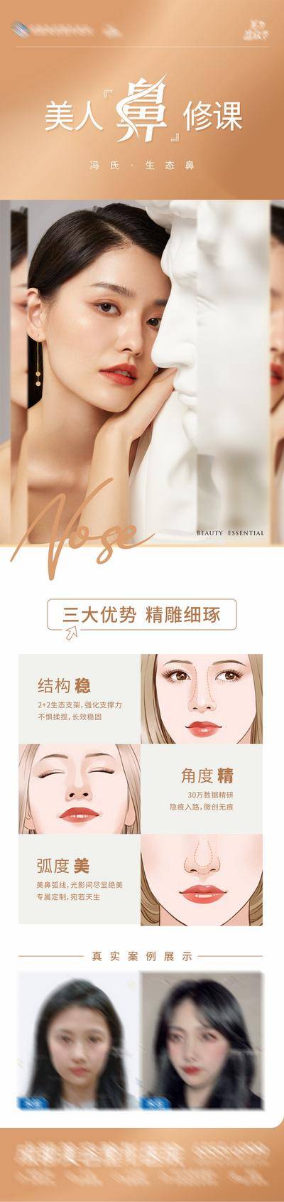 【南门网dcpsd.com】广告 海报 长图 整形 专题 医美 高端 质感 创意 模特 美女 美业 整形 美容 版式 排版设计 大气 高级 朋友圈 微信稿 清新 简洁 美鼻 隆鼻 生态鼻 案例对比