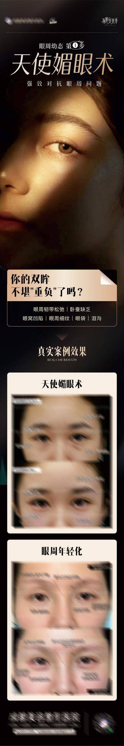 【南门网dcpsd.com】广告 海报 医美 专题 高端 质感 创意 医院 美业 整形 美容 版式 排版设计 大气 高级 模特 微信稿 品牌 宣传 天使媚眼术 案例 眼睛 长图 对比
