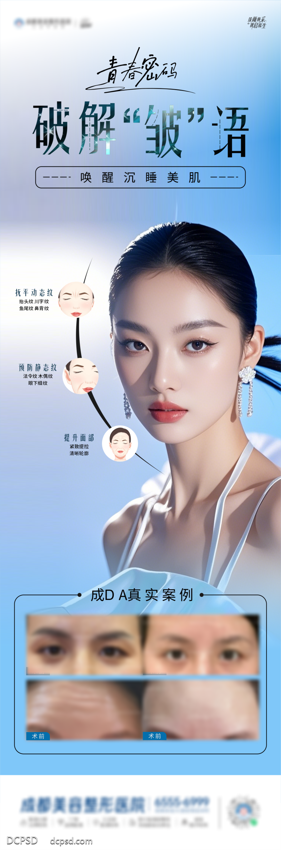 【南门网dcpsd.com】广告 海报 医美 除皱 人物 清晰 唯美 案例 对比 专题 长图