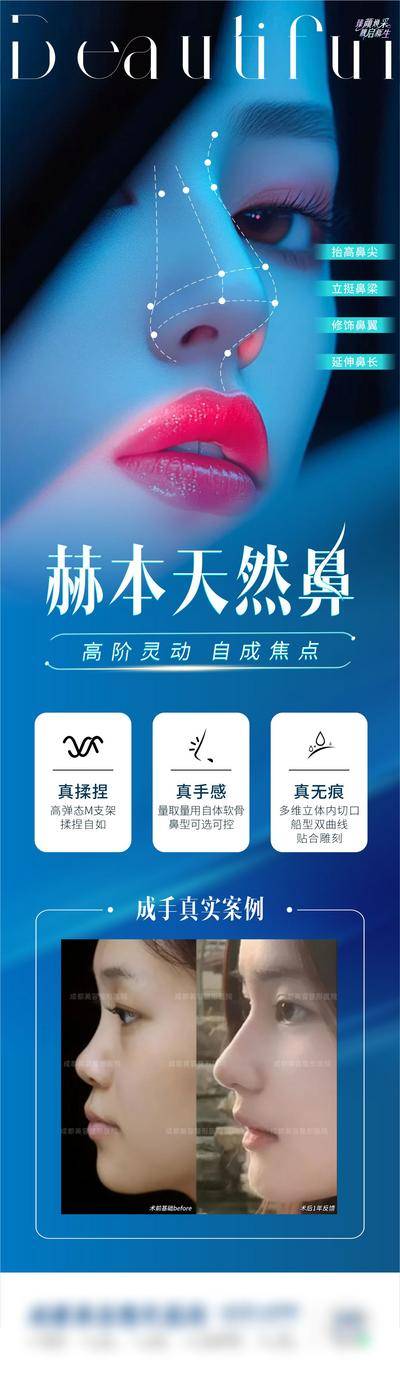 【南门网dcpsd.com】广告 海报 医美 美鼻 整形 光影 案例 效果 对比 品质 高端