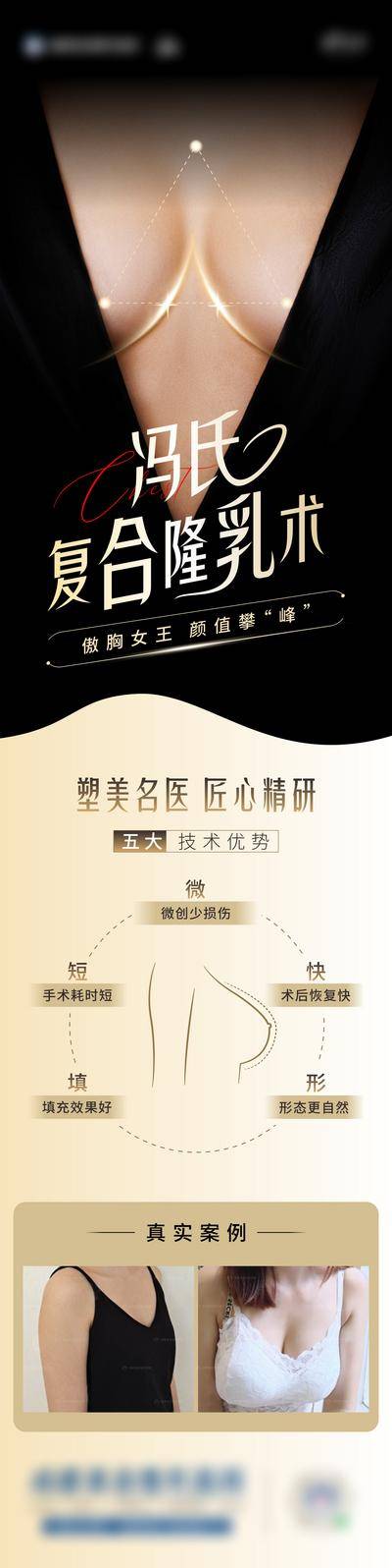 【南门网dcpsd.com】广告 海报 医美 隆胸 丰胸 身材 案例 对比 专题
