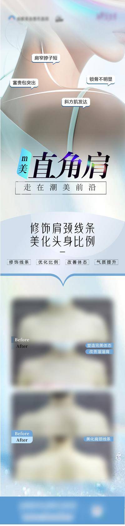 【南门网dcpsd.com】广告 医美 整形 直角肩 肩颈 比例 案例 对比 矫正 长图
