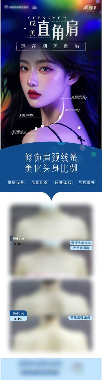 【南门网dcpsd.com】广告 医美 整形 直角肩 肩颈 比例 案例 对比 矫正 长图
