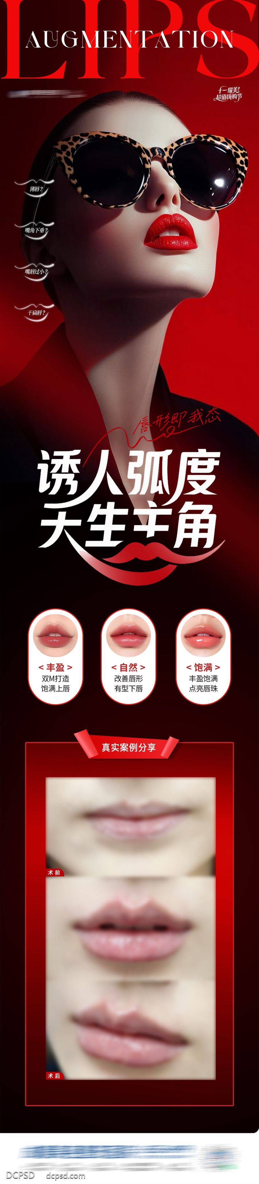 【南门网dcpsd.com】海报 长图 医美 唇部 高端 质感 创意 模特 整形 美容 气质 时尚 版式 排版 大气 宣传 唇部塑形 案例对比 黑红 嘴巴 嘴唇 丰唇 口周年轻 唇部饱满