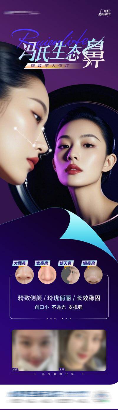 【南门网dcpsd.com】长图 医美 高端 模特 质感 创意 整形 美容 气质 时尚 版式 排版 大气 宣传 冯氏 生态鼻 案例 对比 鼻部 鼻子 鼻综合 鼻基底 鼻子案例 鼻子类型 大蒜鼻 宽鼻梁 朝天鼻 塌鼻梁 卷页
