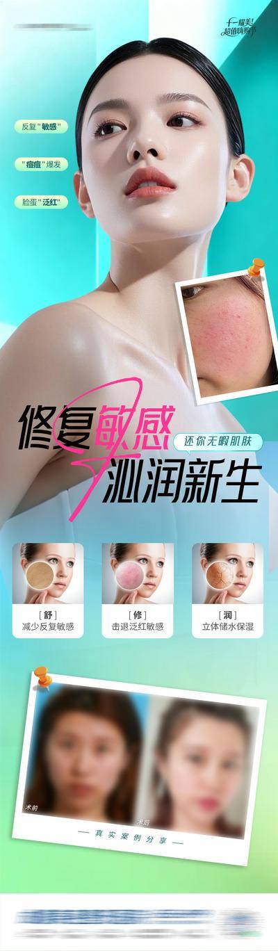 【南门网dcpsd.com】广告 海报 长图 肌肤 医美 人物 高端 质感 创意 敏感肌 泛红 痘痘肌 补水 敏感修复 案例 对比 皮肤 渐变 提夫尼蓝 AI 模特 整形 美容 气质 时尚 版式 排版 大气 宣传