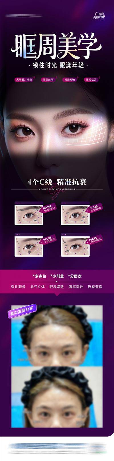 【南门网dcpsd.com】广告 医美 高端 美眼 质感 创意 眼周 眶C 眶周 眼周抗衰 眼睛 美眼 眼袋 眼部 抗衰 逆龄 年轻 黑眼圈 模特 案例 对比图 4个C线 双眼皮 整形 美容 气质 时尚 版式 排版 大气 宣传 眼部