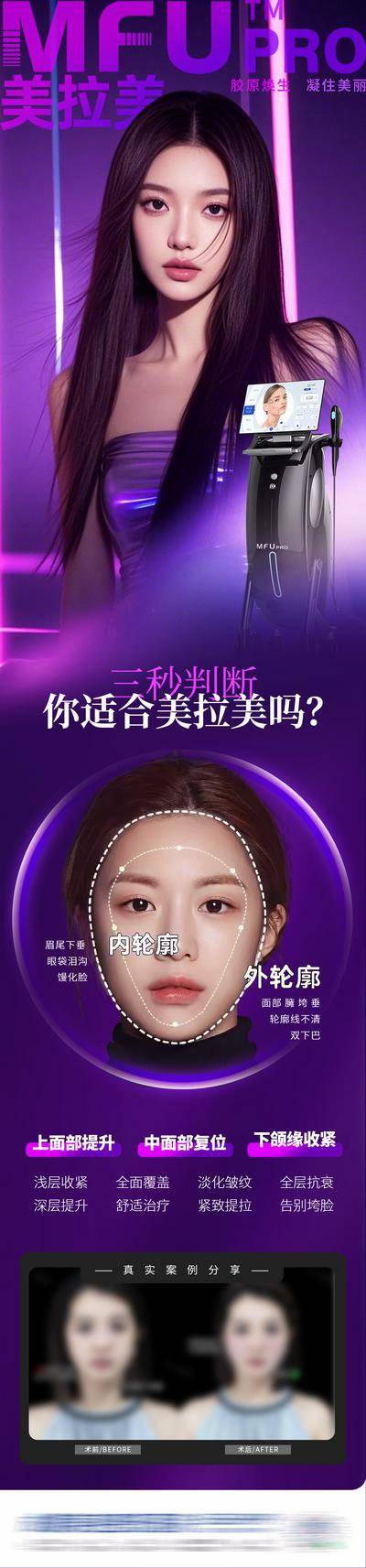 【南门网dcpsd.com】长图 医美 高端 质感 创意 美拉美 仪器 抗衰 案例 对比图 品宣 内轮廓 外轮廓 提升 复位 收紧 超声刀 皮肤 功效 超声炮 模特 整形 美容 气质 时尚 版式 排版 大气 宣传