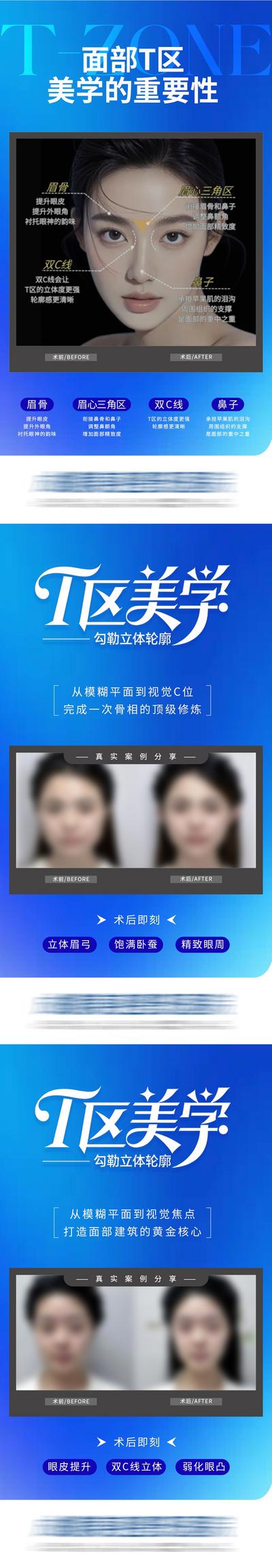 【南门网dcpsd.com】广告 医美 高端 医美 质感 创意 系列 面部T区 美学 立体 轮廓 公众号 案例 对比 科普 宣发 眉骨 眉心三角区 双C线 鼻子 整形 美容 气质 时尚 版式 排版 大气