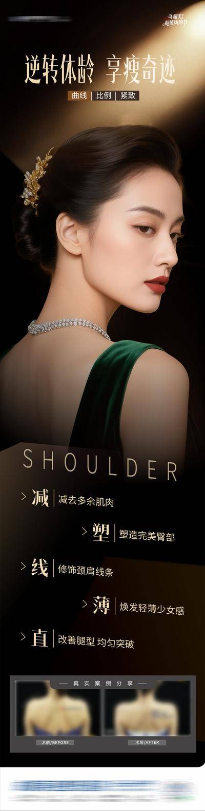 南门网 广告 医美 高端 人物 质感 黑金 创意 光影 肉毒素 塑型 形体 直角肩 案例 肩膀 瘦身 曲线 紧致 线条 减肥 肩颈 铅笔腿 模特 整形 美容 气质 时尚 版式 排版 大气