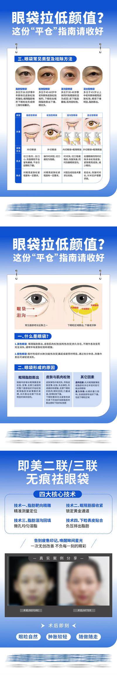 【南门网dcpsd.com】广告 海报 插画 医美 高端 质感 创意 系列 无创 眼袋 眼睛 年轻态 科普 案例 对比 眼袋类型 二联三联 无痕祛眼袋 手绘 公众号 宣发 整形 美容 气质 时尚 版式 排版 大气