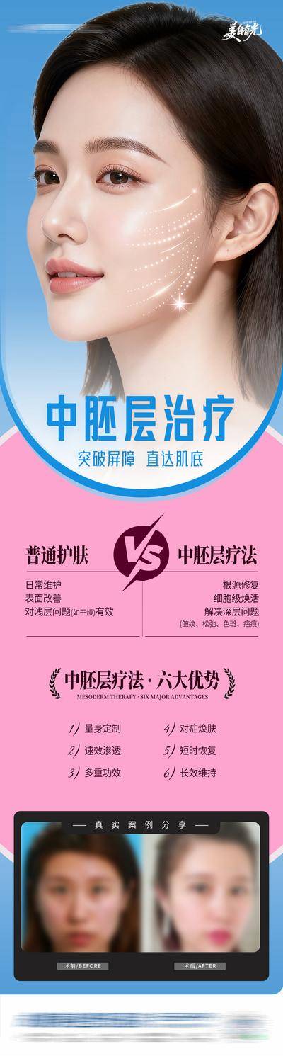 【南门网dcpsd.com】广告 医美 高端 人物 质感 创意 中胚层治疗 VS 6大优势 皮肤 皮肤结构 表皮层 真皮层 皮下组织 案例 对比 清新 敏感 色斑 暗沉 收缩毛孔 泛红 修复 补水 提亮 模特 整形 美容 气质 时尚 版式 排版 大气