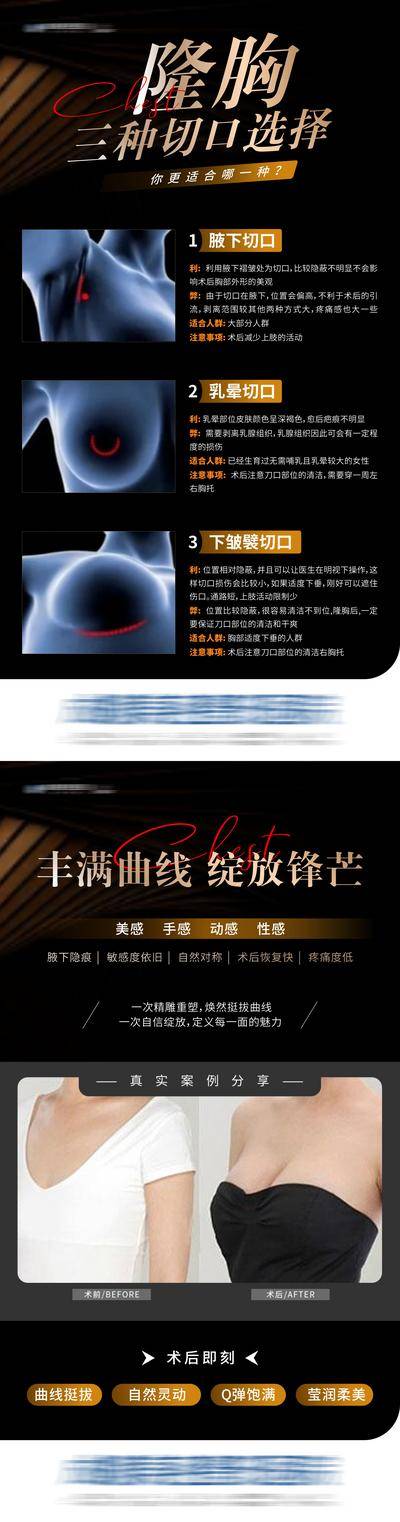 【南门网dcpsd.com】医美 高端 质感 隆胸 黑金 创意 公众号 科普 丰乳 美胸 塑形 私密 曲线 丰满 挺拔 乳房 挺翘 饱满 性感 形体 圆润 隆乳术 案例对比 三种切口选择 模特 整形 美容 气质 时尚 版式 排版 大气