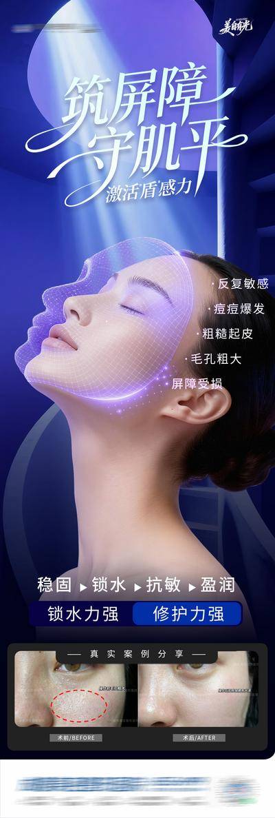 【南门网dcpsd.com】医美 人物 高端 人物 质感 创意 敏感肌 泛红 痘痘肌 屏障修复 补水 保湿 舒缓 祛痘 敏感 修复 科技感 炎症 光影 渐变 案例 对比 皮肤 模特 整形 美容 气质 时尚 版式 大气 宣传