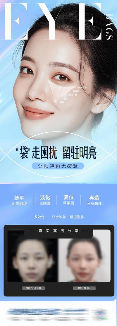 南门网 医美 高端 质感 眼部 创意 午休式祛眼袋 案例 抚平泪沟 淡化黑眼圈 复位苹果肌 卧蚕 眼部 眼袋 眼睛 美眼 紧致 抗衰 淡纹 模特 整形 美容 气质 时尚 版式 大气 宣传 渐变 专题