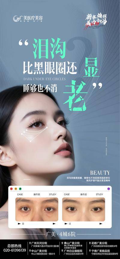 【南门网dcpsd.com】广告 海报 医美 眼部 黑眼圈 眼周 胶原 显老 案例对比