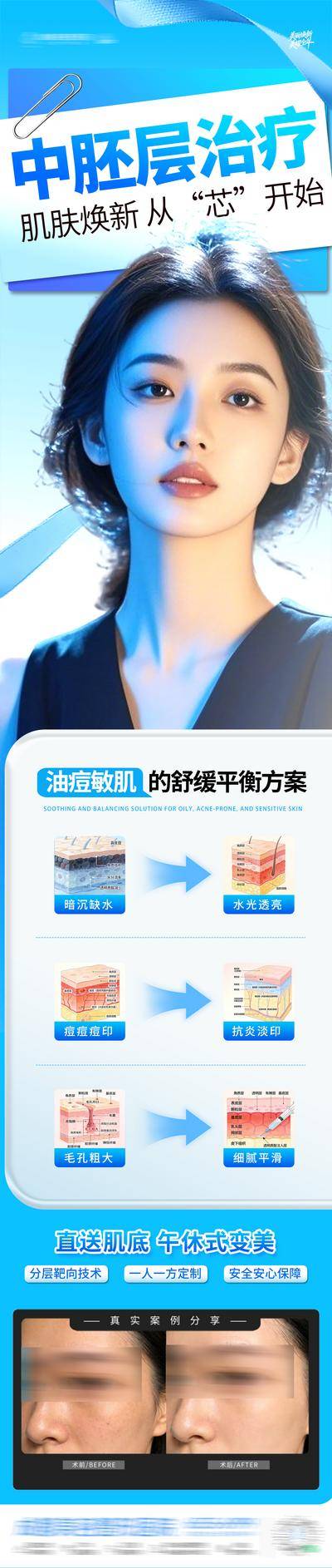 【南门网dcpsd.com】医美 高端 质感 模特 专题 创意 中胚层治疗 油痘肌 敏感肌 皮肤 皮肤结构 舒缓 表皮层 真皮层 皮下组织 案例 对比 色斑 暗沉 收缩毛孔 泛红 修复 补水 提亮 整形 美容 气质 时尚 版式 排版 大气