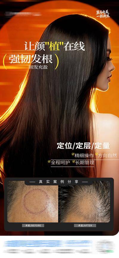 【南门网dcpsd.com】医美 质感 创意 植发 疤痕 斑秃 治疗 微创 头发 生发 头皮 护发 发根 发际线 地中海 案例 渐变 光影 头发浓密 减少掉发 强韧发丝 护理 激活毛囊 精准护理 深层滋养 柔顺发丝 模特 时尚 高级 版式 大气