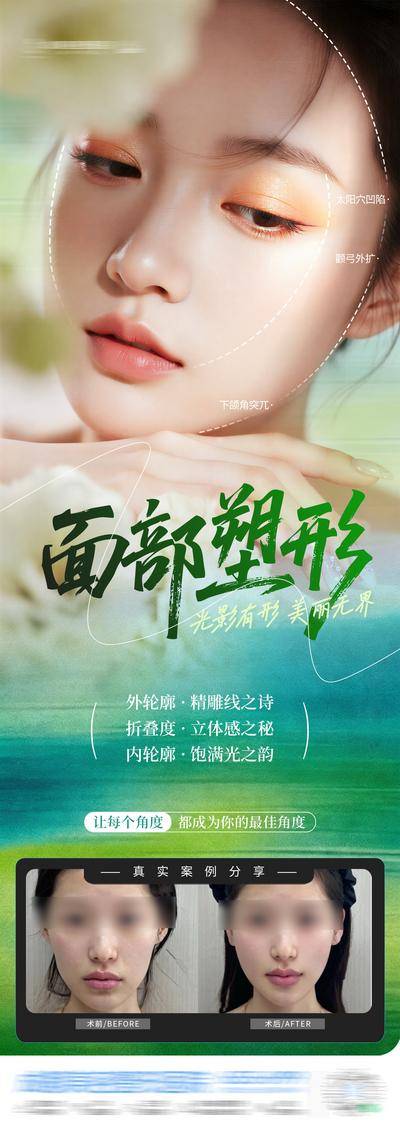南门网 医美 高端 质感 轮廓 创意 面部塑形 立体 塑美 抗衰 外轮廓 折叠度 内轮廓 年轻态 重塑 骨相 饱满 案例 凹陷 颧弓外扩 下颌突兀 清新 渐变 春天 整形 美容 气质 时尚 版式 排版 大气 宣传