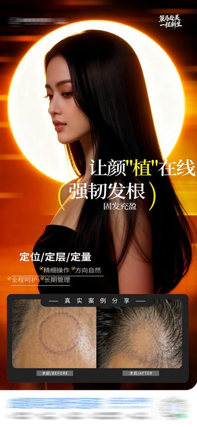 【南门网dcpsd.com】医美 质感 创意 植发 疤痕 斑秃 治疗 微创 头发 生发 头皮 护发 发根 发际线 地中海 案例 渐变 光影 头发浓密 减少掉发 强韧发丝 护理 激活毛囊 精准护理 深层滋养 柔顺发丝 模特 时尚 高级 版式 大气