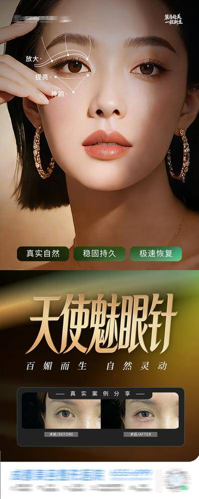 南门网 广告 医美 高端 眼部 质感 黑金 创意 天使媚眼针 案例 眼睛 放大 提亮 神韵 灵动 眶周美学 眼周 眼部 抗衰 胶原 六度立体 年轻 美眼 逆龄 渐变 模特 整形 美容 气质 时尚 版式 高级 大气
