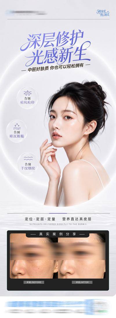 南门网 医美皮肤中胚层深层修护案例创意海报