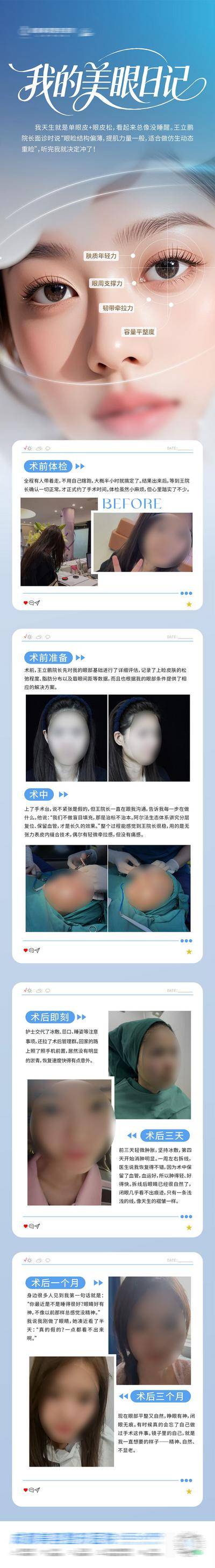 南门网 广告 长图 医美 美眼 高端 质感 创意 阿尔法 生态美眼 眼睛 眼部 眼部整形 双眼皮 眼眸 案例 日记 推文 模特 整形 美容 气质 时尚 版式 大气